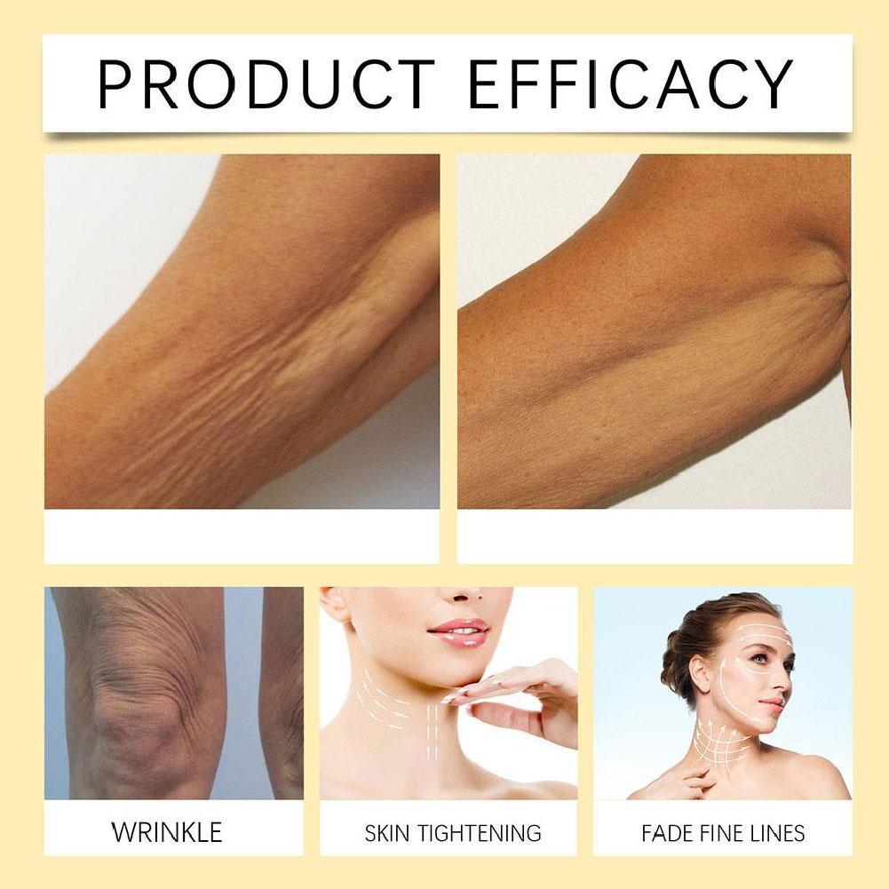 Koreanische Augencreme gegen F – Retinol Anti Wrinkle Cream Bewertung und Preis